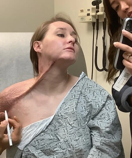 It felt like a hot blade slicing into my neck.